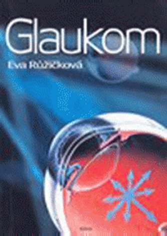 Glaucomul: minim pentru practică