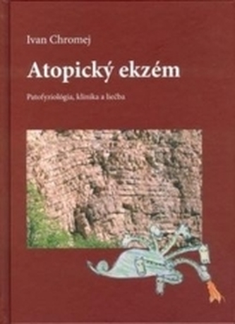 Eczemă atopică