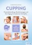 Ventuze (cupping)