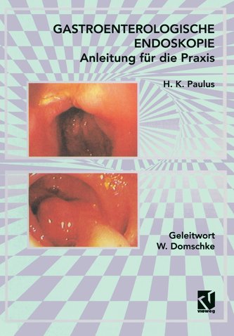 Endoscopie gastroenterologică: Ghid practic