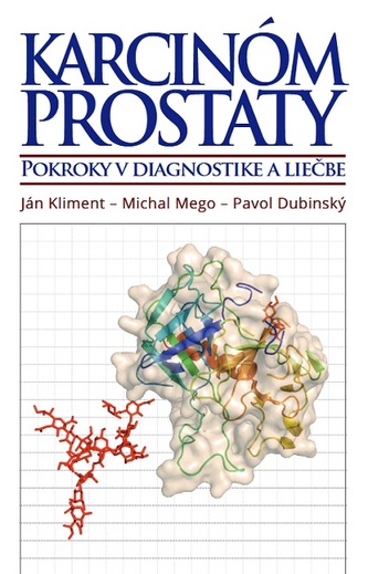 Carcinom de prostată