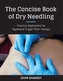 Carte concisă despre dry needling