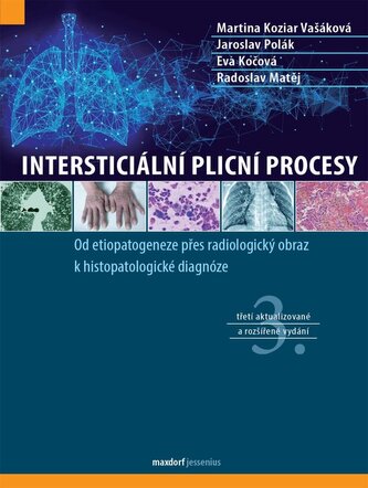 Procese pulmonare interstițiale