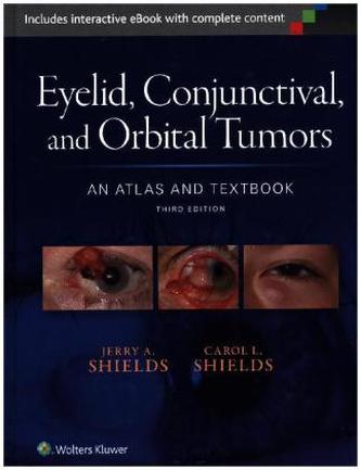 Eyelid