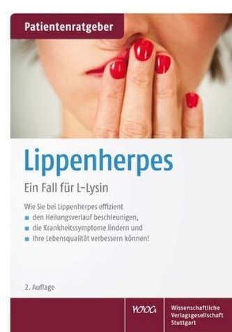 Herpes labial