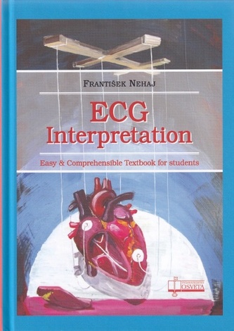 Interpretarea ECG