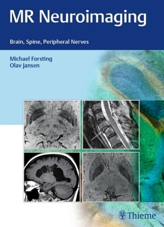 Neuroimagistică RMN