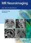 Neuroimagistică RMN
