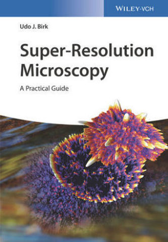 Microscopie cu super-rezoluție