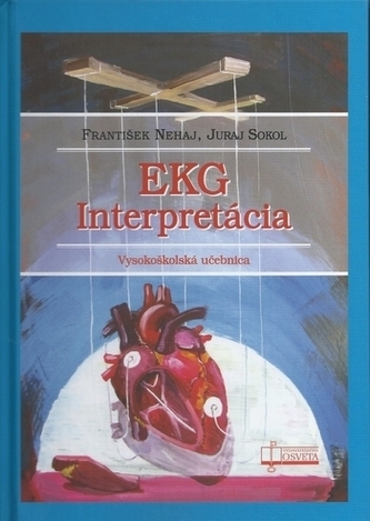 Interpretare EKG