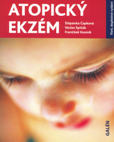 Eczemă atopică