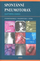 Pneumotorax spontan