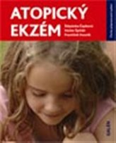 Eczemă atopică